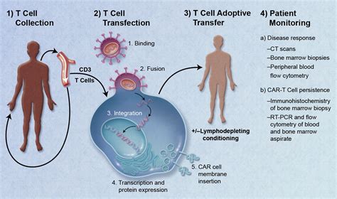 CAR-T Cell Therapy for Lymphoma Leads to Complete Remission in Phase I Trial