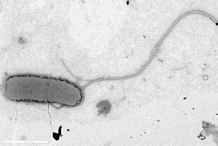 Tipos de flagelo según su localización en bacterias | La guía de Biología