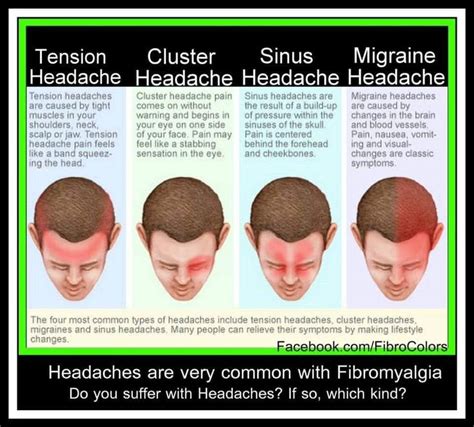 Sinus Migraine, Tension Migraine, Migraine Cause, Cluster Headaches ...