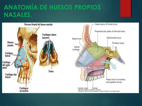 FRACTURA DE HUESOS NASALES - DR. OMAR GONZALES SUAZO.