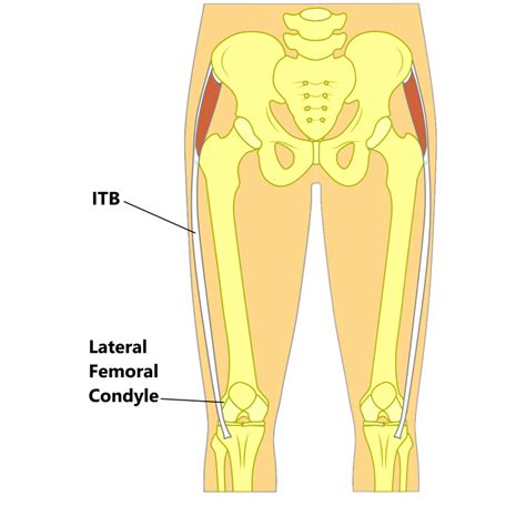 ITB (Iliotibial Band) Syndrome - My Family Physio