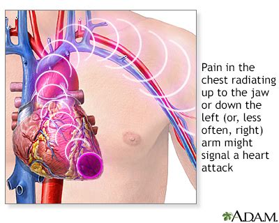 Shoulder pain Information | Mount Sinai - New York