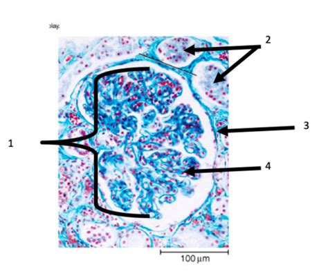 Glomerulus Histology Unit 5 Flashcards | Quizlet