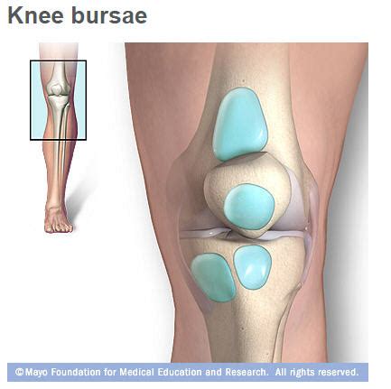 Knee Bursitis Stretches And Exercises Plan (Pes Anserine,, 54% OFF