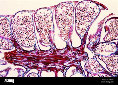 Male pine cone or strobilus showing the pollen. Optical microscope, magnification X40 Stock ...