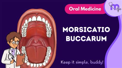 Morsicatio Buccarum | Full Video | Medi Study Go | Oral Medicine - YouTube