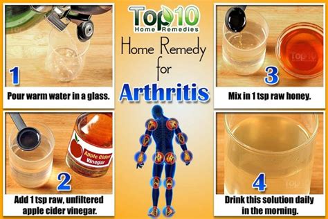 Home Remedies for Arthritis | Top 10 Home Remedies