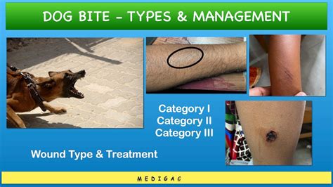 Types Of Dog Bite Wounds Factory Shop | full-mark.com.ar