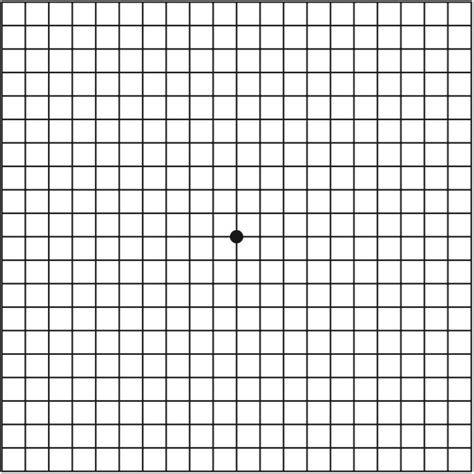 Macular Degeneration - Amsler Grid – Brisbane Retina | Dr Abhishek Sharma