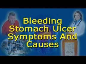 Bleeding Ulcer Symptoms And Causes - How To Know If You Have A Bleeding ...