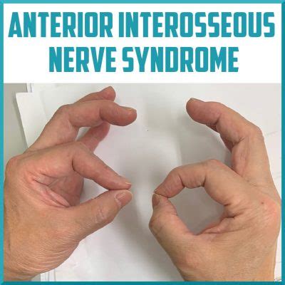 Review of the Anterior Interosseous Nerve Syndrome - Sports Medicine Review