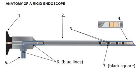 Rigid Scope Anatomy