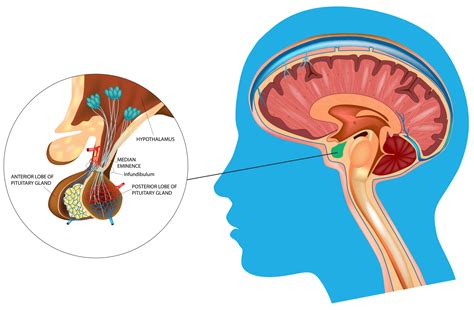 Pituitary Diseases — South Sydney Medical Specialists | Kogarah & Miranda