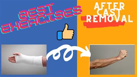 Broken Wrist Exercises after taking off Cast (Fingers-Physical Therapy - YouTube