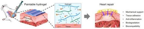 A paintable and adhesive hydrogel cardiac patch with sustained release of ANGPTL4 for infarcted ...