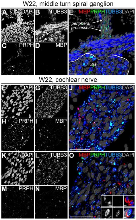 (A–E) Confocal images of a spiral ganglion in the middle turn of a ...