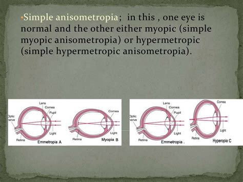 Anisometropia