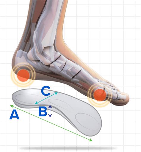 Do I Need Custom Orthotics or an Over the Counter Shoe Insert?