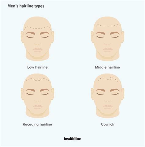 Hairline Types For Men and Women, Plus How to Change Your Type | Men hairline, Hairline, Male ...