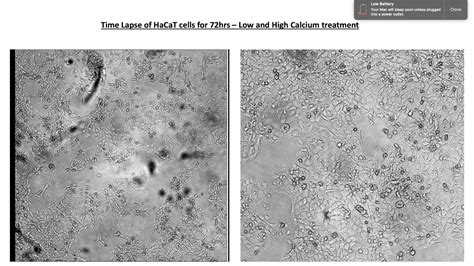 Cell culture - HaCaT Cell Differentiation - YouTube