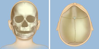 Symptoms of Craniosynostosis | Weill Cornell Brain and Spine Center