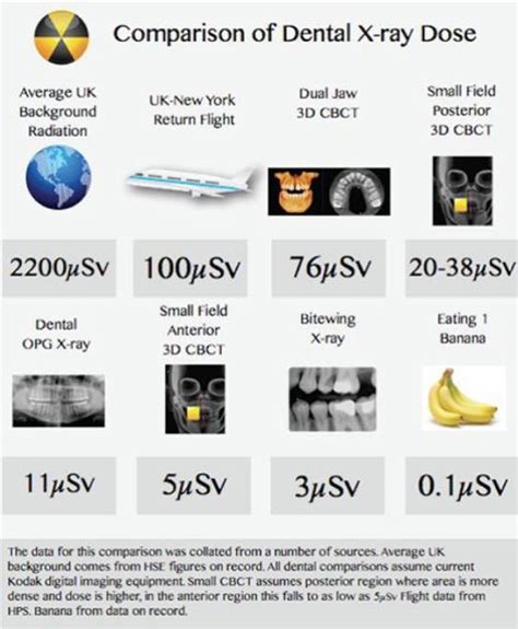 Dental Radiation Exposure Comparison Chart