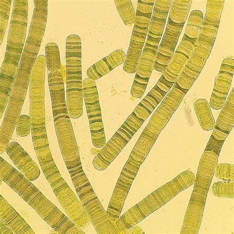 Oscillatoria Under A Microscope