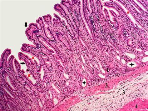 Histology Atlas Online®: Stomach – Slide 08