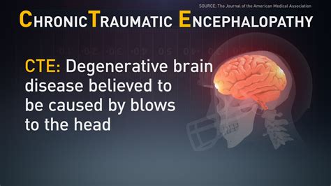 What is CTE and how does football increase the risk? | wthr.com