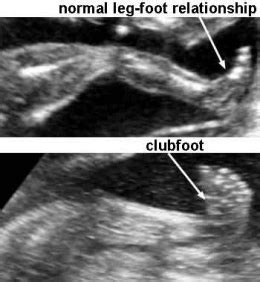 OBSTETRIC ULTRASOUND - SMC OB-GYNE ULTRASOUND CLINIC