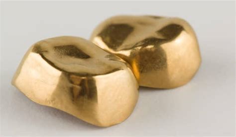 How Did We end up with Gold Teeth? The Weird History of Dental Crowns ...