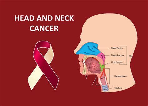 Neck Cancer Stages