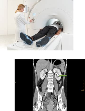 CT Urogram | CT Scan in Hyderabad | Medintu