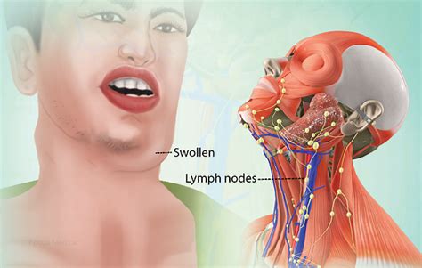 Health Condition : Symptoms, Causes, Treatment and More