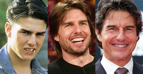 alan adı hikaye çıkık tom cruise teeth before and after yas yayın Altı