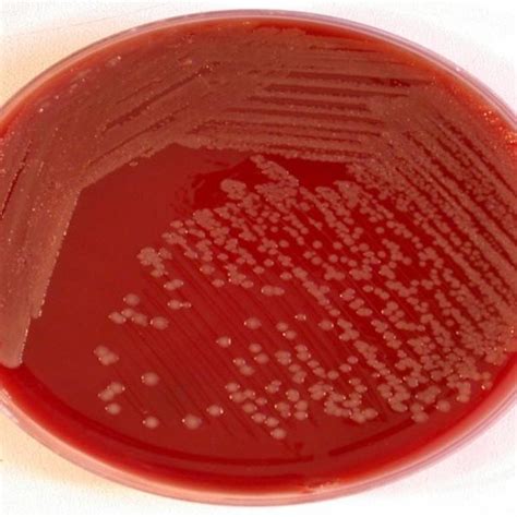 (PDF) Isolation and characterization of thermostable protease producing Bacillus pumilus from ...