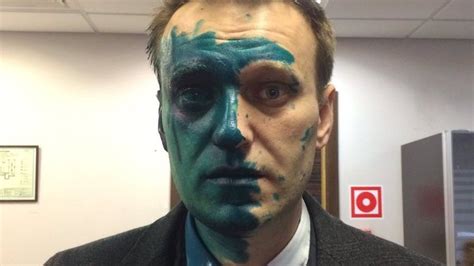 Russia opposition leader Alexei Navalny attacked with "brilliant green ...