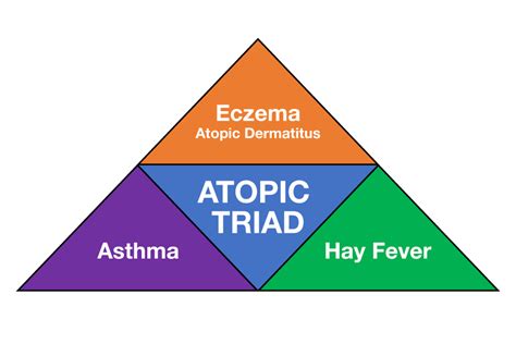 Are Eczema, Asthma, and Hay Fever Connected? - Soothems