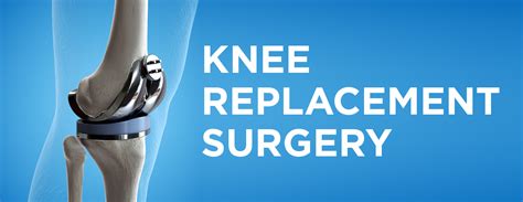 Knee Replacement Surgery: Procedure, Types and Risks | Memon Medical ...