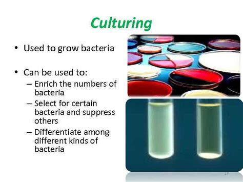 Bacterial Culture Methods By Konrad T Juszkiewicz MD