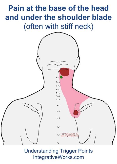 Pin on Invisible Illnesses & Pain Mgt