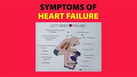 Symptoms And Complications Of Heart Failure Heart Fai - vrogue.co