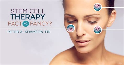 Stem Cell Facelifts – Are They for Real? - Adamson MD Associates ...