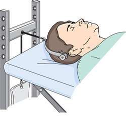 Crutchfield tongs | definition of Crutchfield tongs by Medical dictionary