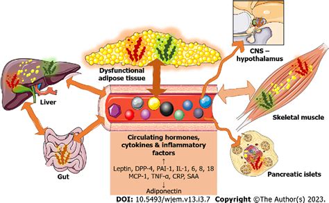 Figure 1 from Physiopathological mechanisms related to inflammation in obesity and type 2 ...