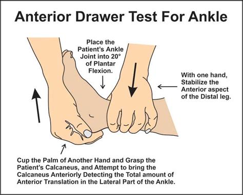 Anterior-drawer-test-ankle by austinsilva on DeviantArt