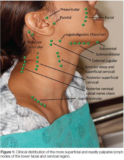 Posterior Lymph Nodes