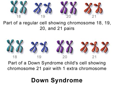 Disease vs. Syndrome