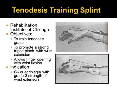 tenodesis splints: A patient with a C6 spinal cord injury can use a ...