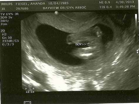 Jaxon's Journey: Week 14 ultrasound-It's a BOY!!